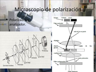 Microscopio de polarización
 Polarizador y
  analizador.
 