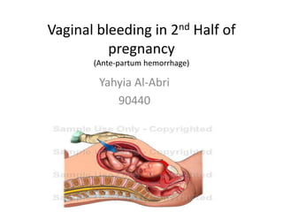 Vaginal bleeding in 2nd Half of
pregnancy
(Ante-partum hemorrhage)
Yahyia Al-Abri
90440
 