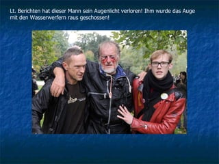 Lt. Berichten hat dieser Mann sein Augenlicht verloren! Ihm wurde das Auge mit den Wasserwerfern raus geschossen! 
