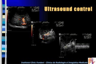 Ultrasound control 