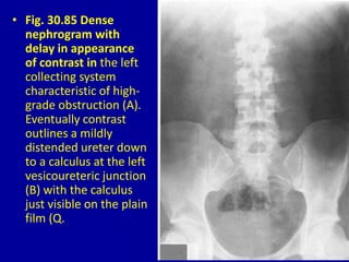 30 DAVID SUTTON PICTURES THE KIDNEY AND URETERS | PPTX