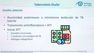Tuberculosis ocular mexico la luz clases de uvea | PPTX