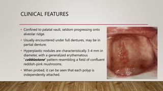 30. Connective Tissue Oral Lesions (1).pptx