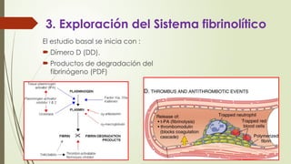 3. Exploración del Sistema fibrinolítico
El estudio basal se inicia con :
 Dímero D (DD).
 Productos de degradación del
fibrinógeno (PDF)
 