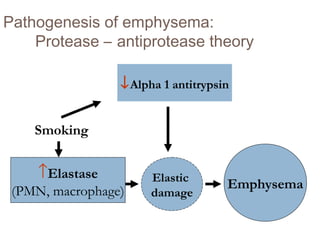 Pathogenesis of emphysema:
Protease – antiprotease theory
↓Alpha 1 antitrypsin
↑Elastase
(PMN, macrophage)
Elastic
damage
Emphysema
Smoking
 