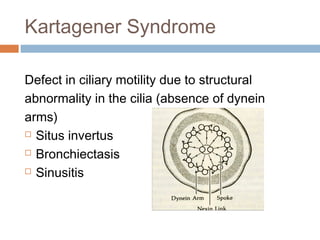 Kartagener Syndrome
Defect in ciliary motility due to structural
abnormality in the cilia (absence of dynein
arms)
 Situs invertus
 Bronchiectasis
 Sinusitis
 