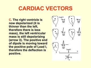 CARDIAC VECTORS C . The right ventricle is now depolarized (it is thinner than the left, therefore there is less mass), the left ventricular mass is still depolarizing (arrow 3). The positive end of dipole is moving toward the positive pole of Lead I, therefore the deflection is positive.  