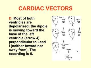 CARDIAC VECTORS D . Most of both ventricles are depolarized; the dipole is moving toward the base of the left ventricle (arrow 4) perpendicular to Lead I (neither toward nor away from).  The recording is 0.   