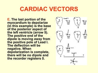 CARDIAC VECTORS E . The last portion of the myocardium to depolarize (in this example) is the base of the posterior aspect of the left ventricle (arrow 5). The positive end of the dipole is moving away from the positive pole of Lead I. The deflection will be negative. When depolarization is complete, there will be no dipole and the recorder registers 0.  