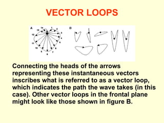 VECTOR LOOPS Connecting the heads of the arrows representing these instantaneous vectors inscribes what is referred to as a vector loop, which indicates the path the wave takes (in this case). Other vector loops in the frontal plane might look like those shown in figure B.  
