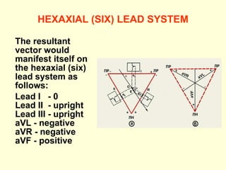 HEXAXIAL (SIX) LEAD SYSTEM The resultant vector would manifest itself on the hexaxial (six) lead system as follows:  Lead I  - 0  Lead II  - upright  Lead III - upright  aVL - negative  aVR - negative  aVF - positive 