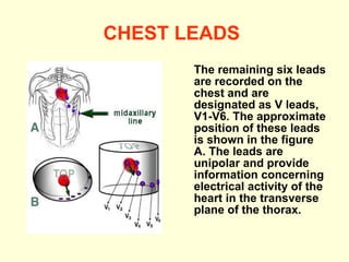 CHEST LEADS   The remaining six leads are recorded on the chest and are designated as V leads, V1-V6. The approximate position of these leads is shown in the figure A. The leads are unipolar and provide information concerning electrical activity of the heart in the transverse plane of the thorax.  