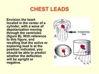 CHEST LEADS Envision the heart located in the center of a cylinder, with a wave of depolarization moving through the ventricles (figure B). With reference to this figure, and recalling that the active or exploring lead is at the position indicated, you should be able to predict whether the deflection will be upright or negative.  