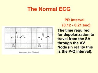 The Normal ECG PR interval ( 0 .12 -  0 .21 sec) The time required for depolarization to travel from the SA through the AV Node (in reality this is the P-Q interval). 