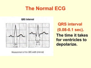 The Normal ECG QRS interval  ( 0 .08- 0 .1 sec) . The time it takes for ventricles to depolarize.  