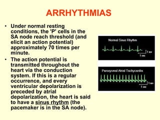 ARRHYTHMIAS   Under normal resting conditions, the 'P' cells in the SA node reach threshold (and elicit an action potential) approximately 70 times per minute. The action potential is transmitted throughout the heart via the conduction system. If this is a regular occurrence, and every ventricular depolarization is preceded by atrial depolarization, the heart is said to have a  sinus rhythm  (the pacemaker is in the SA node).  