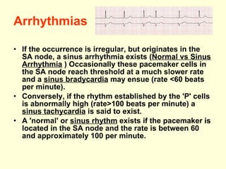 Arrhythmias If the occurrence is irregular, but originates in the SA node, a sinus arrhythmia exists ( Normal vs Sinus Arrhythmia  ) Occasionally these pacemaker cells in the SA node reach threshold at a much slower rate and a  sinus bradycardia  may ensue (rate <60 beats per minute).  Conversely, if the rhythm established by the 'P' cells is abnormally high (rate>100 beats per minute) a  sinus tachycardia  is said to exist. A 'normal' or  sinus rhythm  exists if the pacemaker is located in the SA node and the rate is between 60 and approximately 100 per minute.  