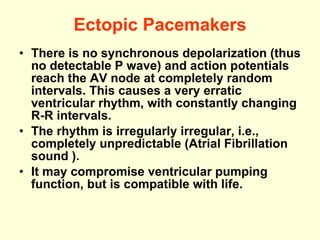 Ectopic Pacemakers There is no synchronous depolarization (thus no detectable P wave) and action potentials reach the AV node at completely random intervals.  This causes a very erratic ventricular rhythm, with constantly changing R-R intervals. The rhythm is irregularly irregular, i.e., completely unpredictable (Atrial Fibrillation sound ). It may compromise ventricular pumping function, but is compatible with life. 
