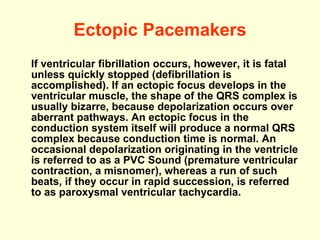 Ectopic Pacemakers If ventricular fibrillation occurs, however, it is fatal unless quickly stopped (defibrillation is accomplished). If an ectopic focus develops in the ventricular muscle, the shape of the QRS complex is usually bizarre, because depolarization occurs over aberrant pathways.  An ectopic focus in the conduction system itself will produce a normal QRS complex because conduction time is normal.  An occasional depolarization originating in the ventricle is referred to as a PVC Sound (premature ventricular contraction, a misnomer), whereas a run of such beats, if they occur in rapid succession, is referred to as paroxysmal ventricular tachycardia.  