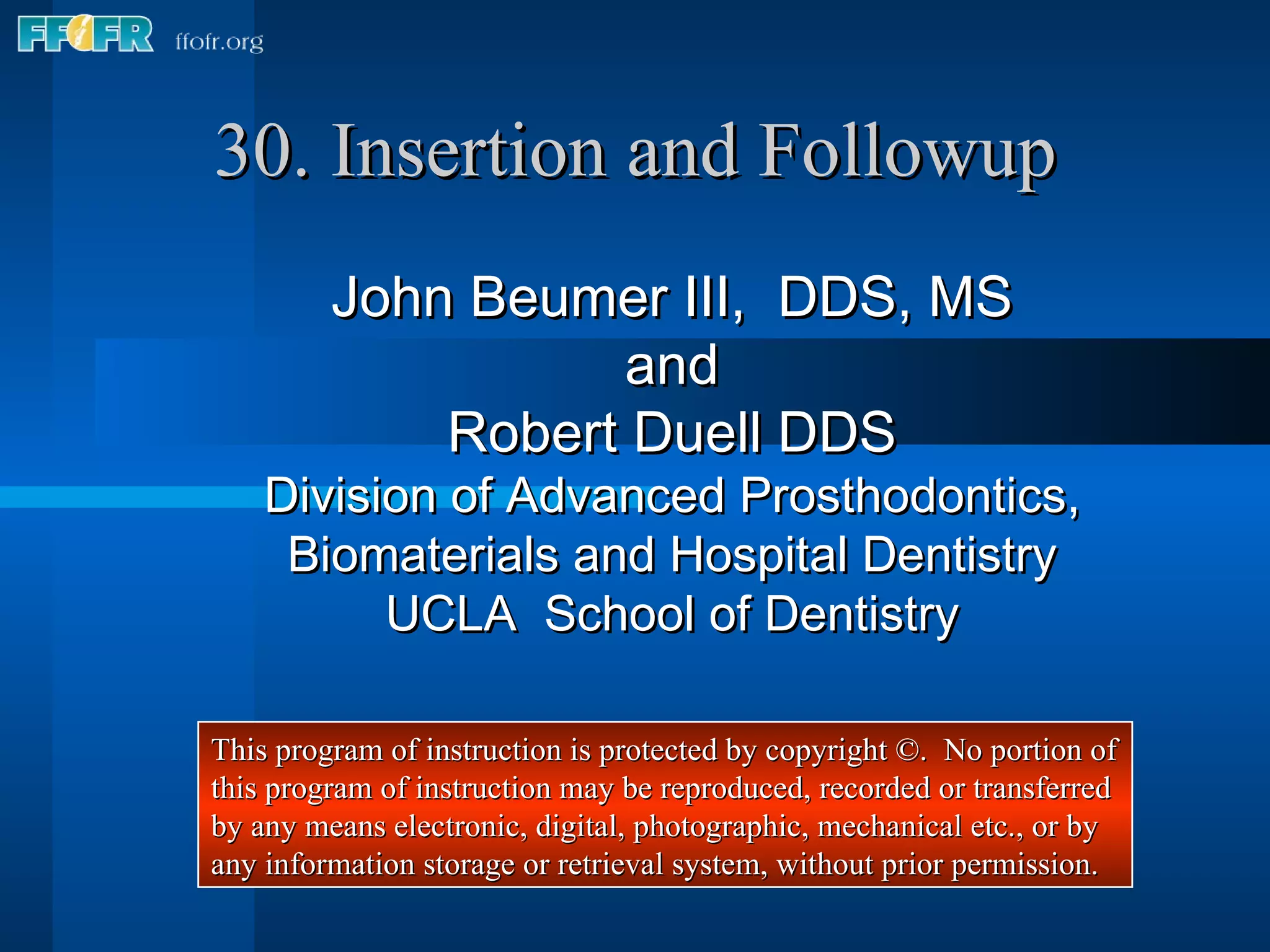 30. Insertion and Followup John Beumer III,  DDS, MS and Robert Duell DDS Division of Advanced Prosthodontics, Biomaterials and Hospital Dentistry UCLA  School of Dentistry This program of instruction is protected by copyright ©.  No portion of this program of instruction may be reproduced, recorded or transferred by any means electronic, digital, photographic, mechanical etc., or by any information storage or retrieval system, without prior permission. 