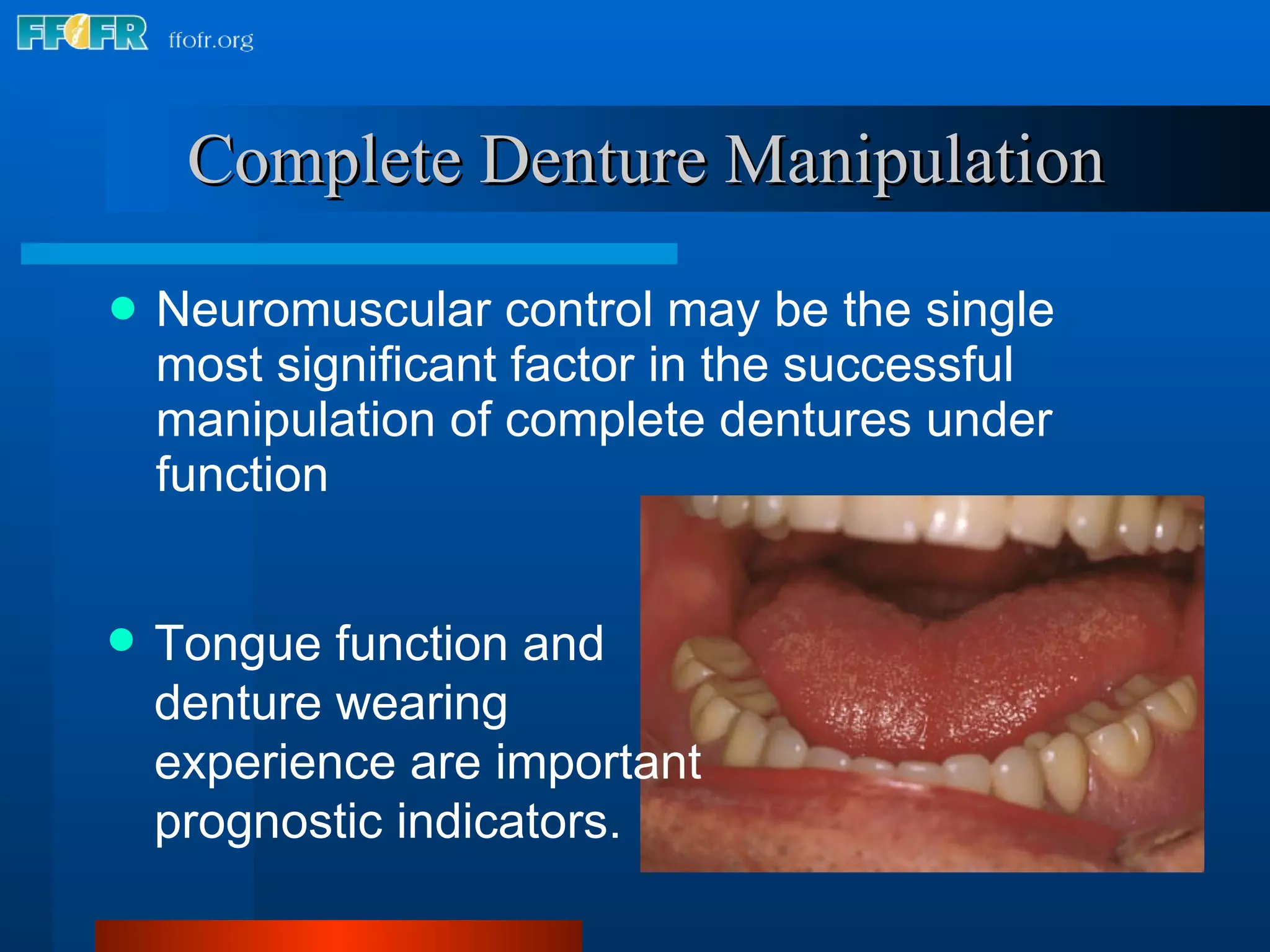 Neuromuscular control may be the single most significant factor in the successful manipulation of complete dentures under function Complete Denture Manipulation Tongue function and denture wearing experience are important prognostic indicators. 