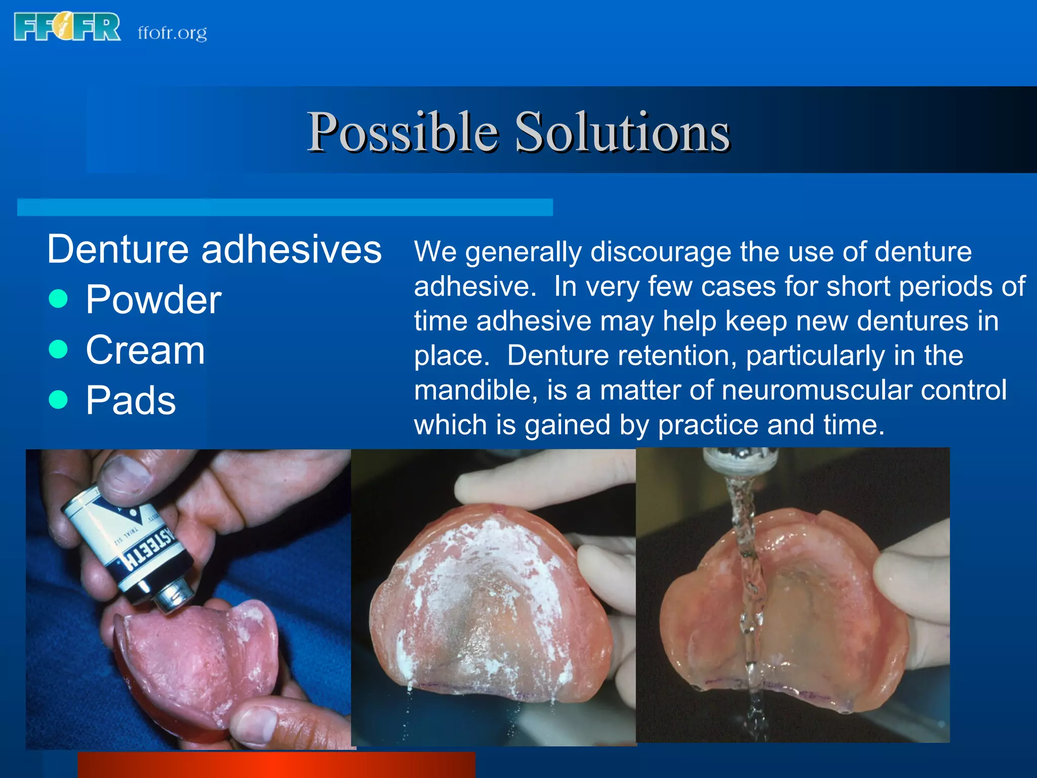 Possible Solutions Denture adhesives Powder Cream  Pads We generally discourage the use of denture adhesive.  In very few cases for short periods of time adhesive may help keep new dentures in place.  Denture retention, particularly in the mandible, is a matter of neuromuscular control which is gained by practice and time. 