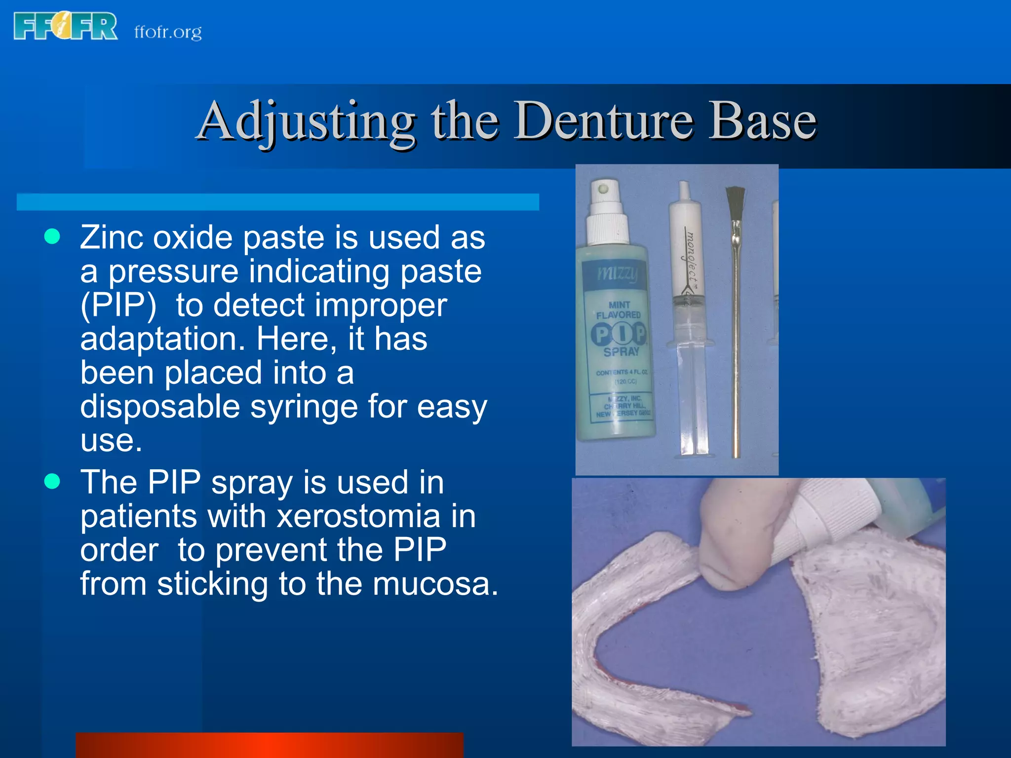 Adjusting the Denture Base Zinc oxide paste is used as a pressure indicating paste (PIP)  to detect improper adaptation. Here, it has been placed into a disposable syringe for easy use.  The PIP spray is used in patients with xerostomia in order  to prevent the PIP from sticking to the mucosa. 