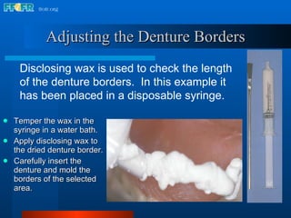 Adjusting the Denture Borders Temper the wax in the syringe in a water bath. Apply disclosing wax to the dried denture border. Carefully insert the denture and mold the borders of the selected area. Disclosing wax is used to check the length of the denture borders.  In this example it has been placed in a disposable syringe. 