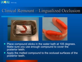 Place compound sticks in the water bath at 105 degrees.  Make sure you use enough compound to cover the posterior teeth. Apply the melted compound to the occlusal surfaces of the posterior teeth. Clinical Remount – Lingualized Occlusion 