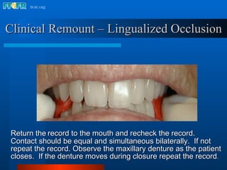 Return the   record to the mouth and recheck the record.  Contact should be equal and simultaneous bilaterally.  If not repeat the record. Observe the maxillary denture as the patient closes.  If the denture moves during closure repeat the record .  Clinical Remount – Lingualized Occlusion 