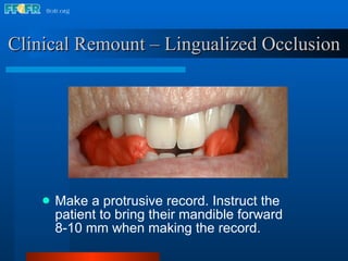 Make a protrusive record. Instruct the patient to bring their mandible forward 8-10 mm when making the record. Clinical Remount – Lingualized Occlusion 