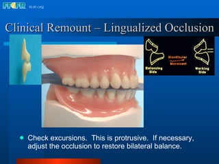 Check excursions.  This is protrusive.  If necessary, adjust the occlusion to restore bilateral balance. Clinical Remount – Lingualized Occlusion 