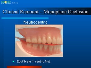 Clinical Remount – Monoplane Occlusion Equilibrate in centric first. Neutrocentric 
