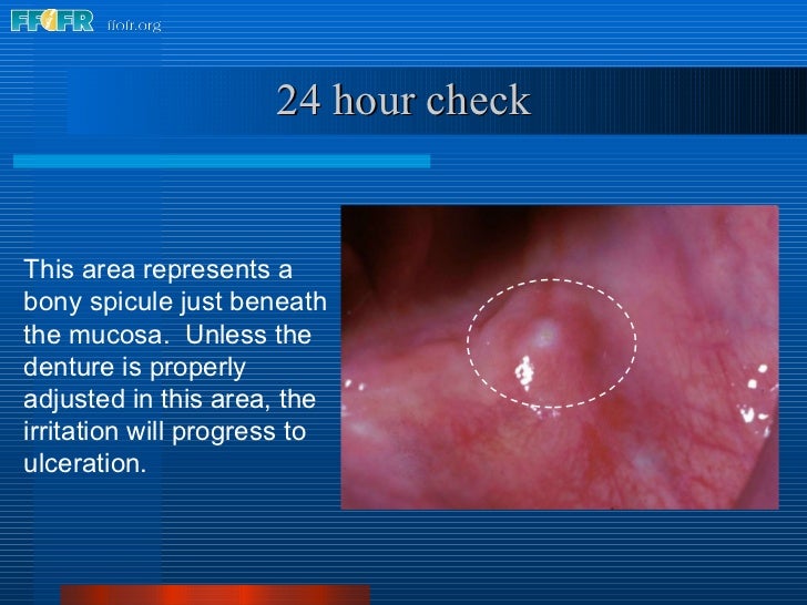 30.insertion and followup