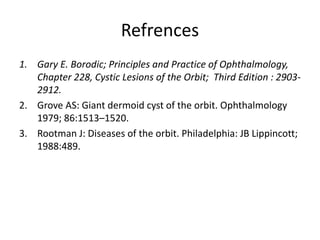 Refrences
1. Gary E. Borodic; Principles and Practice of Ophthalmology,
Chapter 228, Cystic Lesions of the Orbit; Third Edition : 2903-
2912.
2. Grove AS: Giant dermoid cyst of the orbit. Ophthalmology
1979; 86:1513–1520.
3. Rootman J: Diseases of the orbit. Philadelphia: JB Lippincott;
1988:489.
 