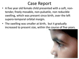 Case Report
• A five year old female child presented with a soft, non-
tender, freely movable, non-pulsatile, non reducible
swelling, which was present since birth, over the left
supero-temporal orbital margin.
• The swelling was smaller at birth, but it gradually
increased to present size, within the course of five years.
 