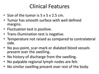 Clinical Features
• Size of the tumor is 5 x 5 x 2.5 cm.
• Tumor has smooth surface with well defined
margins.
• Fluctuation test is positive.
• Trans-illumination test is negative.
• Temperature not raised as compared to contralateral
side.
• No pus-point, scar-mark or dialated blood vessels
present over the swelling.
• No history of discharge from the swelling.
• No palpable regional lymph nodes are felt.
• No similar swelling present over rest of the body.
 