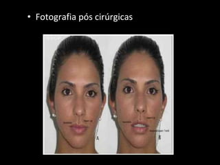 • Fotografia pós cirúrgicas
 