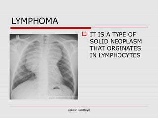 LYMPHOMA
 IT IS A TYPE OF
SOLID NEOPLASM
THAT ORGINATES
IN LYMPHOCYTES
rakesh vallittayil
 