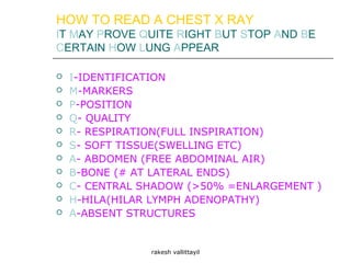 HOW TO READ A CHEST X RAY
IT MAY PROVE QUITE RIGHT BUT STOP AND BE
CERTAIN HOW LUNG APPEAR
 I-IDENTIFICATION
 M-MARKERS
 P-POSITION
 Q- QUALITY
 R- RESPIRATION(FULL INSPIRATION)
 S- SOFT TISSUE(SWELLING ETC)
 A- ABDOMEN (FREE ABDOMINAL AIR)
 B-BONE (# AT LATERAL ENDS)
 C- CENTRAL SHADOW (>50% =ENLARGEMENT )
 H-HILA(HILAR LYMPH ADENOPATHY)
 A-ABSENT STRUCTURES
rakesh vallittayil
 