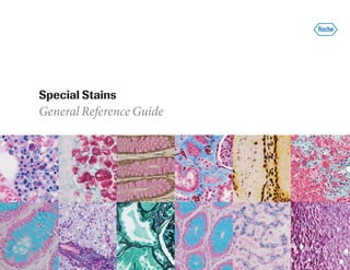 Special Stains
General Reference Guide
 