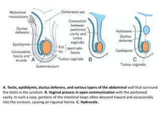 Development of genital system | PPTX
