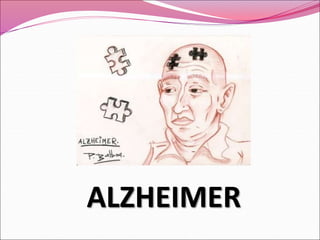 ALZHEIMER
 