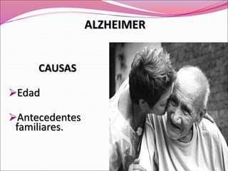 CAUSAS
Edad
Antecedentes
familiares.
ALZHEIMER
 