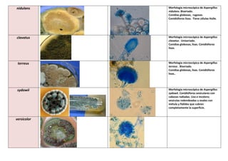 nidulans Morfología microscópica de Aspergillus
nidulans. Biseriado.
Conidias globosas, rugosas.
Conidióforos lisos. Tiene células Hulle.
clavatus Morfología microscópica de Aspergillus
clavatus . Uniseriado.
Conidias globosas, lisas. Conidióforos
lisos.
terreus Morfología microscópica de Aspergillus
terreus . Biseriado.
Conidias globosas, lisas. Conidióforos
lisos..
sydowii Morfología microscópica de Aspergillus
sydowii. Conidióforos vesiculares con
cabezas radiadas. Liso e incoloro;
vesículas redondeadas u ovales con
métula y fiálides que cubren
completamente la superficie.
versicolor
 