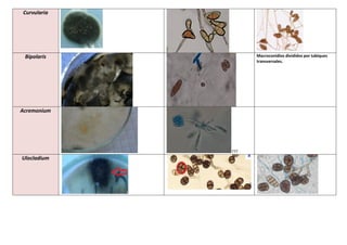 Curvularia
Bipolaris Macroconidios divididos por tabiques
transversales.
Acremonium
???
Ulocladium
 