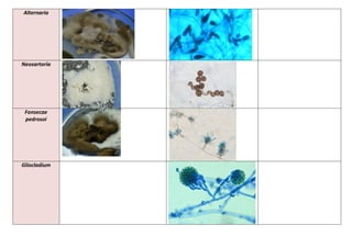 Alternaria
Neosartoria
Fonsecae
pedrosoi
Gliocladium
 