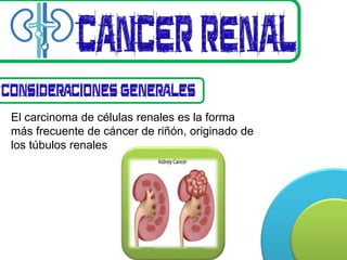 El carcinoma de células renales es la forma
más frecuente de cáncer de riñón, originado de
los túbulos renales
 