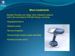 More treatments Besides Psoriasis and vitiligo, other indications respond well to the narrowband UVB light therapy, including: Hypopigmentations Alopecia areata Mycosis fungoides Diverse atopic eczema, atopic dermatitis Erythema anulare (EAC) 