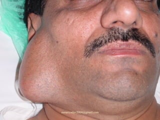 sumeryadav2004@gmail.com
 